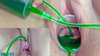 Japanese Lesbians Experiment With Cervix And Urethral Expansion Using Injections